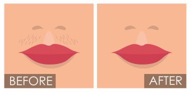 kadın yüzleri epilasyon öncesi ve sonrası vektör çizim tasarım