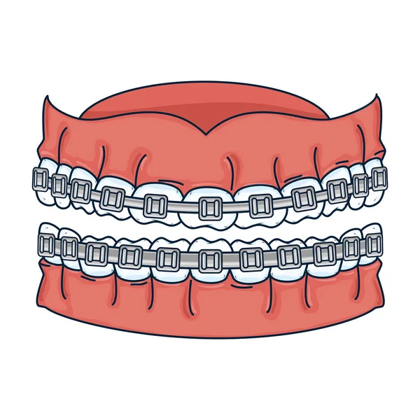 Menschliche Zähne mit Kieferorthopädie — Stockvektor