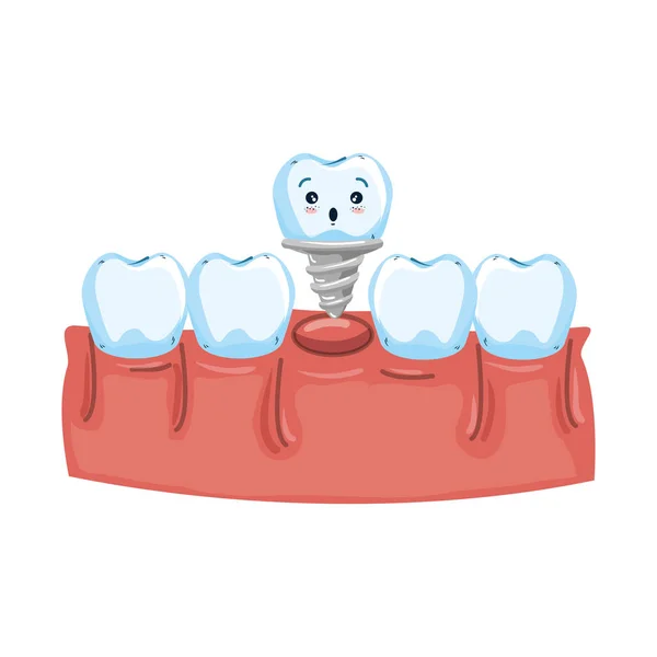 歯科インプラント可愛いとヒトの歯 — ストックベクタ