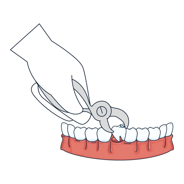 Extrakce zubu zubař s kleště — Stockový vektor