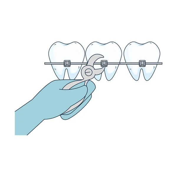 Menselijke tanden met hand orthodontist en tangen — Stockvector