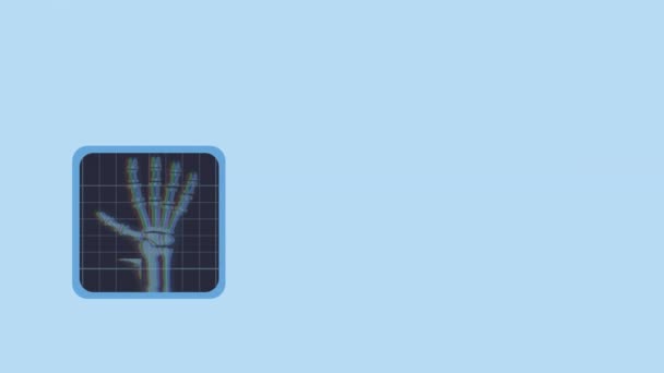 Exploración de la mano hueso rx animación médica — Vídeo de stock