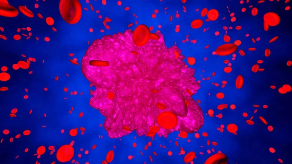 Vér-rák az emberi szervezetben — Stock Fotó