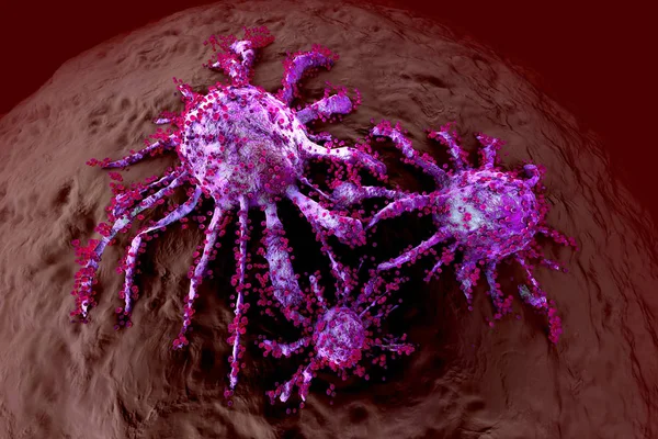 Раковые клетки, распространяющиеся на здоровые ткани — стоковое фото