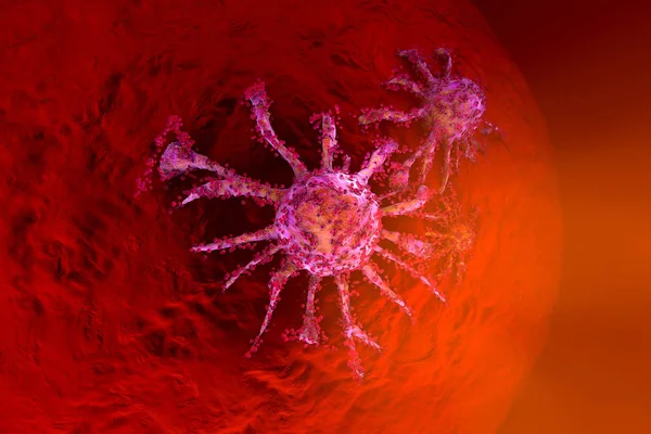 Uma célula cancerígena em crescimento espalhando-se no tecido saudável — Fotografia de Stock