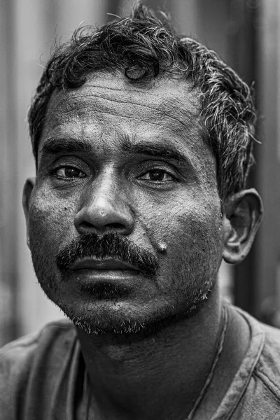 Sundarpur India 2013 Unidentified Indian Leprosy Patient Local Leprosy Hospital — 图库照片