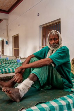 Sundarpur, Hindistan - 2013: Hindistan 'ın Bihar eyaletindeki yerel bir cüzzamlı hastanesinde kimliği belirsiz Hintli cüzzamlı hastalar