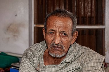 Sundarpur, Hindistan - 2013: Hindistan 'ın Bihar eyaletindeki yerel bir cüzzamlı hastanesinde kimliği belirsiz Hintli cüzzamlı hastalar