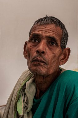 Sundarpur, Hindistan - 2013: Hindistan 'ın Bihar eyaletindeki yerel bir cüzzamlı hastanesinde kimliği belirsiz Hintli cüzzamlı hastalar