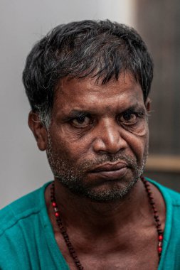 Sundarpur, Hindistan - 2013: Hindistan 'ın Bihar eyaletindeki yerel bir cüzzamlı hastanesinde kimliği belirsiz Hintli cüzzamlı hastalar