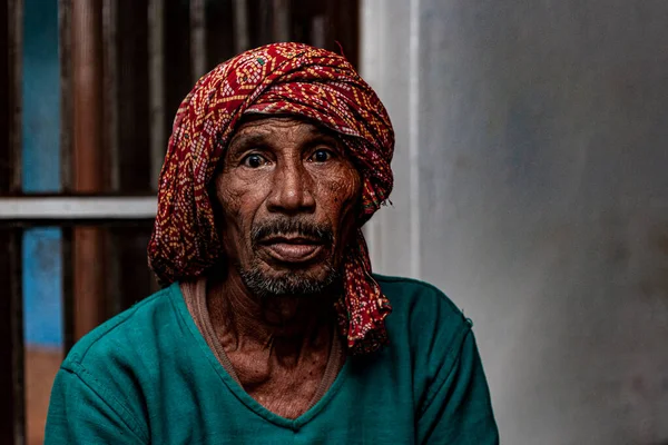 Sundarpur, Hindistan - 2013: Hindistan 'ın Bihar eyaletindeki yerel bir cüzzamlı hastanesinde kimliği belirsiz Hintli cüzzamlı hastalar