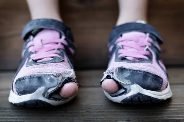 Bambino Senzatetto Che Indossa Vecchie Scarpe Usurate Sui Piedi Con — Foto Stock