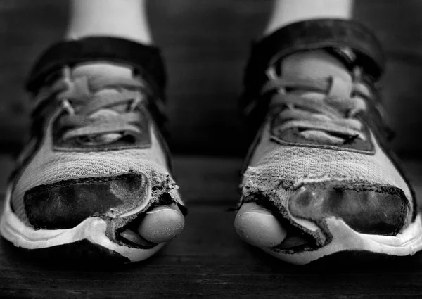 Άστεγο Παιδί Φοράει Παλιά Φθαρμένα Παπούτσια Στα Πόδια Τρύπες Στα — Φωτογραφία Αρχείου