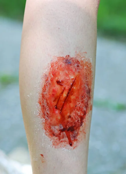 Make Wound Scares Womans Leg — Stock Photo, Image