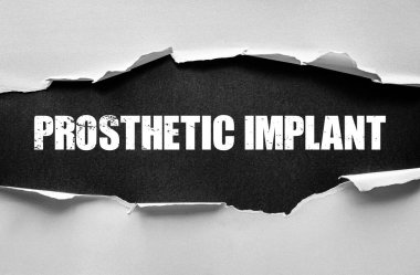 Yırtık kağıt dokuma arka plan, sağlık, yenilik, ameliyat, rehabilitasyon, teknoloji, bilim ve modern tasarım üzerine koyu sıkıntılı stencil yazı tipi ile PROStheTIC IMPLANT kelimelerini ortaya koyuyor