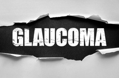Yırtık kağıt, dokuma arka plan, tıp, sağlık, görme, farkındalık, önleme, araştırma, tedavi, bilim ve modern tasarım üzerine koyu sıkıntılı stencil font ile GLAUCOMA sözcüğünü ortaya koyuyor.