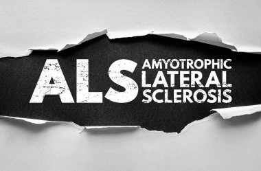 ALS Amyotrofik Lateral Sclerosis metni yırtık kağıt tasarımı ile ortaya çıkarıldı, motor nöronları etkileyen nörodejeneratif hastalık hakkında farkındalığı ve eğitimi temsil ediyor.