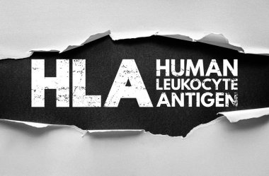 Yırtık kağıt üzerinde insan lökosit antijen metni. Bağışıklık sistemine bağlı tıbbi konsept, doku tipi, organ nakli, otoimmün hastalıklar ve genetik araştırma
