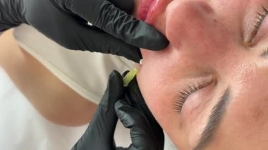 Yüz gerdirme PDO dikiş operasyonu. Yeni iplik kaldırmanın yenilikçi tekniği, kozmetolog kadın müşteriye prosedür uygulamaya hazırlanıyor, uygun iplik seçeneğini seçin. Yüksek kalite 4k görüntü