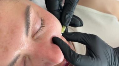 Yüz gerdirme PDO dikiş operasyonu. Yeni iplik kaldırmanın yenilikçi tekniği, kozmetolog kadın müşteriye prosedür uygulamaya hazırlanıyor, uygun iplik seçeneğini seçin. Yüksek kalite 4k görüntü