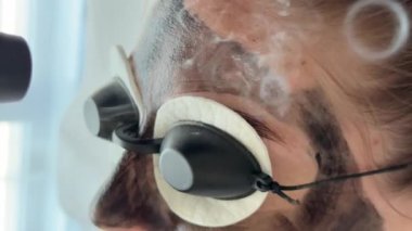 Genç bir kadın güzellik kliniğinde karbon lazer yüz bakımı yaptırıyor. Derin gözenek temizleme, sivilce küçültme ve cilt tazeleme için profesyonel cilt bakımı. Modern kozmetoloji prosedürü