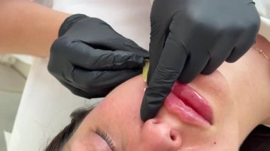 Yüz gerdirme PDO dikiş operasyonu. Yeni iplik kaldırmanın yenilikçi tekniği, kozmetolog kadın müşteriye prosedür uygulamaya hazırlanıyor, uygun iplik seçeneğini seçin. Yüksek kalite 4k görüntü