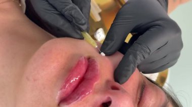 Yüz gerdirme PDO dikiş operasyonu. Yeni iplik kaldırmanın yenilikçi tekniği, kozmetolog kadın müşteriye prosedür uygulamaya hazırlanıyor, uygun iplik seçeneğini seçin. Yüksek kalite 4k görüntü