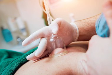 Bir kadın için Vakum masaj yapıyor Doktor görünümü Kapat