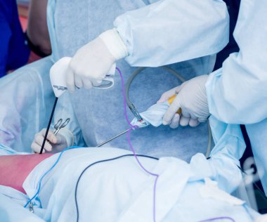 Cerrahlar cerrahi eksizyon tümör, Grup