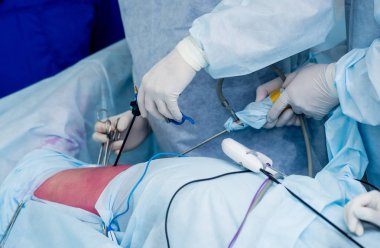 Cerrahlar cerrahi eksizyon tümör, Grup