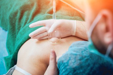 Bir kadın için Vakum masaj yapıyor Doktor görünümü Kapat