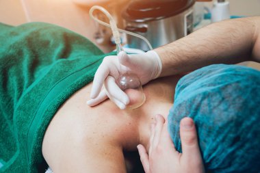 Bir kadın için Vakum masaj yapıyor Doktor görünümü Kapat