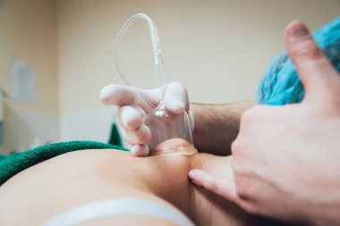 Bir kadın için Vakum masaj yapıyor Doktor görünümü Kapat