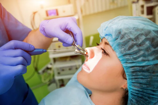 Vaporización Láser Concha Nasal Con Método Tecnología Coblación Cirugía Endoscópica — Foto de Stock