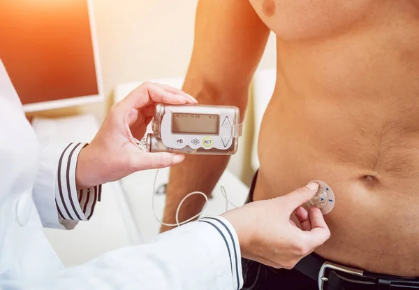 Doctor with an insulin pump connected in patient abdomen and holding the insulin pump at his hands. Diabetes concept.