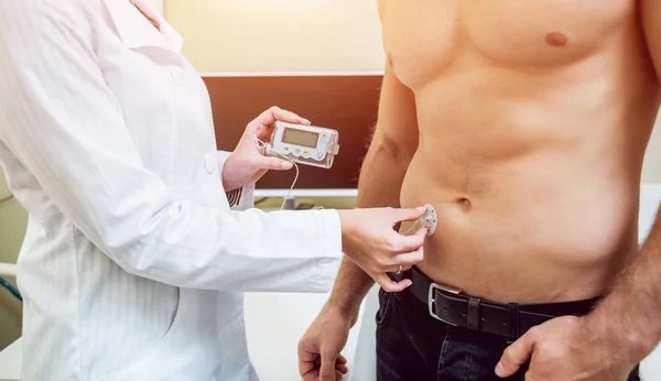 Doctor with an insulin pump connected in patient abdomen and holding the insulin pump at his hands. Diabetes concept.