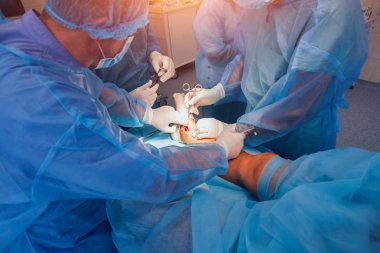 Travma cerrahisi operasyon süreci. Ameliyathane cerrahi ekipman ile cerrahlarından grubudur. Tıbbi geçmişi