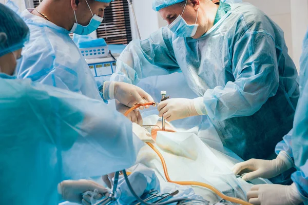 Verfahren Der Gynäkologischen Operation Mit Laparoskopischen Geräten Gruppe Von Chirurgen — Stockfoto