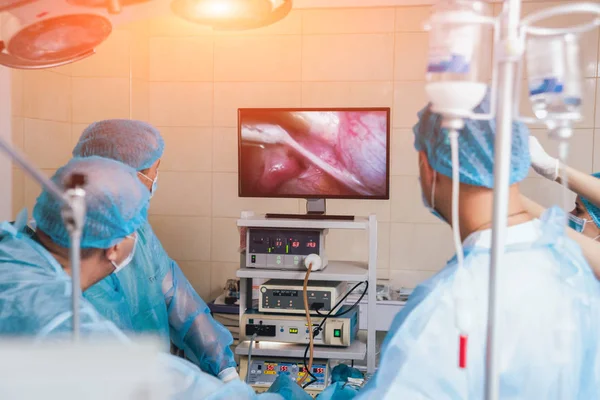 Processo Cirurgia Ginecológica Usando Equipamentos Laparoscópicos Grupo Cirurgiões Centro Cirúrgico — Fotografia de Stock