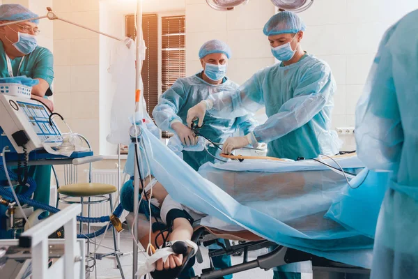 Процесс Операции Гинекологической Хирургии Использованием Лапароскопического Оборудования Группа Хирургов Операционной — стоковое фото