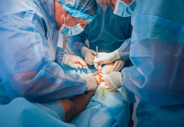 Proceso Cirugía Trauma Grupo Cirujanos Quirófano Con Equipo Quirúrgico Formación — Foto de Stock