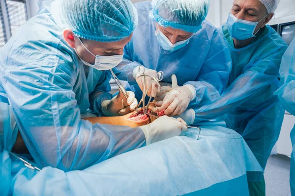 Proces Trauma Chirurgie Operace Skupina Lékařů Operační Místnosti Vybavením Chirurgie — Stock fotografie