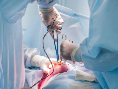 Cerrah ve asistanlar ameliyathanede ameliyat ekipmanlarıyla. Tıbbi geçmiş