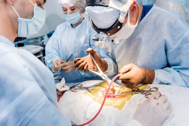 Omurilik ameliyatı. Ameliyathanede ameliyathanede ameliyat aleti olan bir grup cerrah. Laminektomi. Modern tıbbi arka plan