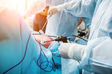 Laparoskopik ekipman kullanılarak yapılan jinekolojik ameliyat. Ameliyathanede ameliyat ekipmanlarıyla bir grup cerrah. Tıbbi geçmiş