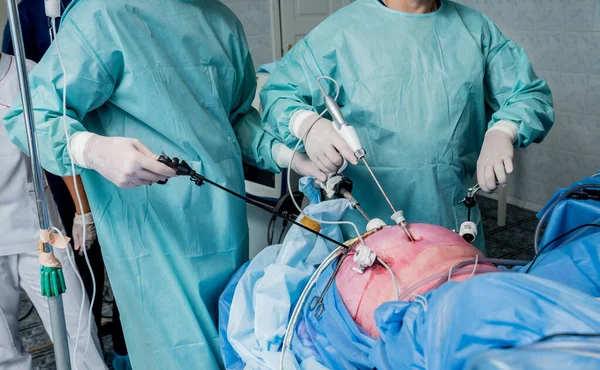 Process of gynecological surgery operation using laparoscopic equipment. Group of surgeons in operating room with surgery equipment. Medical background