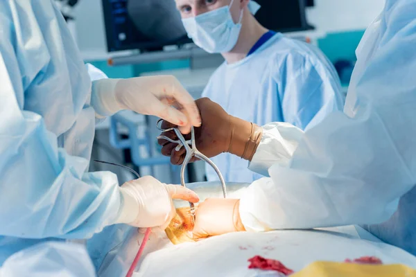 Chirurgie de la colonne. Groupe de chirurgiens en salle d'opération avec équipement chirurgical. Laminectomie — Photo