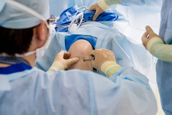 수술이요 수술실에서 현대적 절단기를 사용하는 정형외과 의사들이 일하고 수술이요 병원의 — 스톡 사진