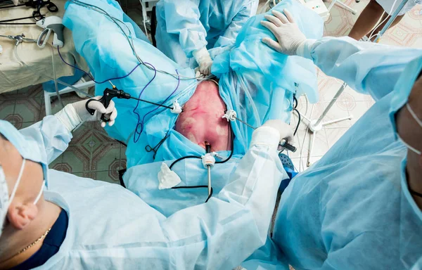 Proces Gynekologického Chirurgického Zákroku Použití Laparoskopického Vybavení Skupina Chirurgů Operačním — Stock fotografie