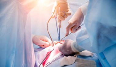 Cerrah ve asistanlar ameliyathanede ameliyat ekipmanlarıyla. Tıbbi geçmiş